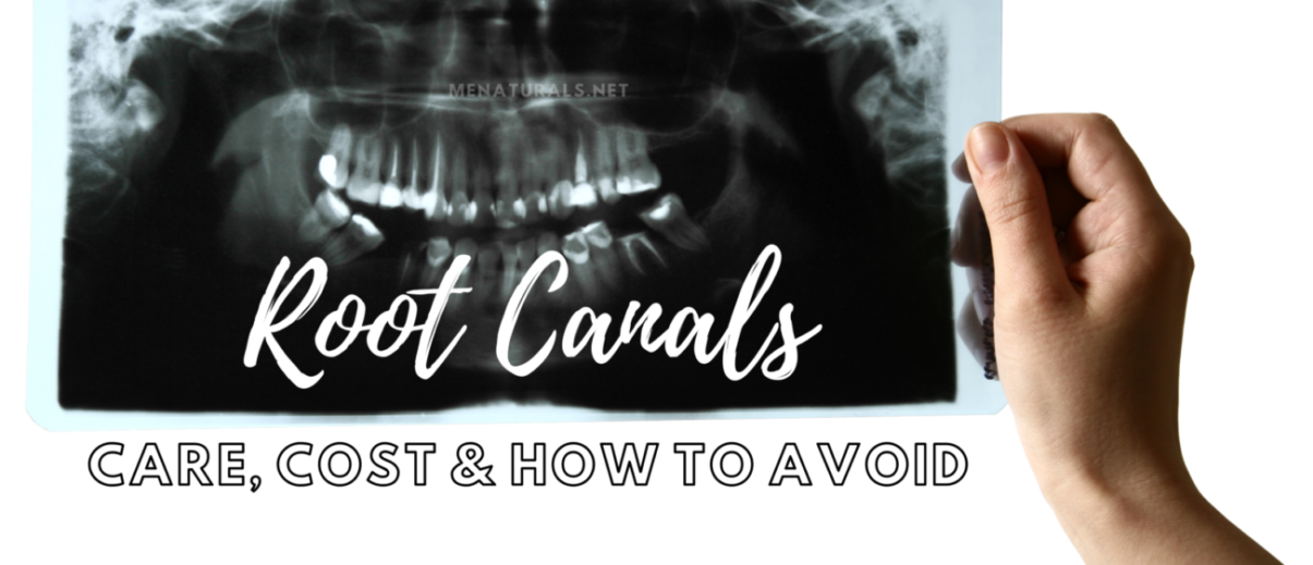 Root Canals | Care, Cost and How to Avoid